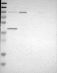 NBP1-84032 - DYRK1A