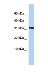 NBP1-55525 - DYSFIP1