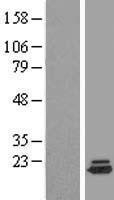 NBL1-10079 - DYSFIP1 Lysate
