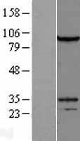 NBL1-10082 - DZIP1L Lysate