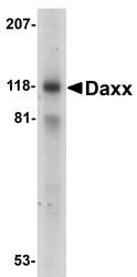NBP1-77011 - DAXX