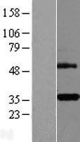 NBL1-17158 - DcR3 Lysate