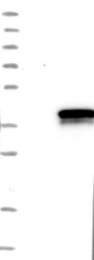 NBP1-84975 - Dedol-PP synthase