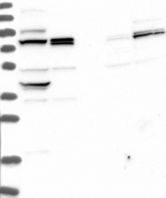 NBP1-87964 - Dedol-PP synthase