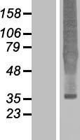 NBL1-13942 - Delta Opioid Receptor Lysate