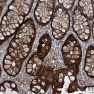 NBP1-84256 - Deoxyguanosine kinase