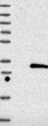 NBP1-84256 - Deoxyguanosine kinase