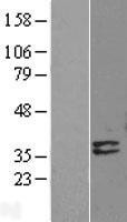 NBL1-09960 - Deoxyribonuclease I like 1 Lysate