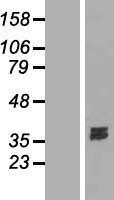 NBL1-09961 - Deoxyribonuclease I like 1 Lysate