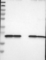 NBP1-88023 - Derlin-1