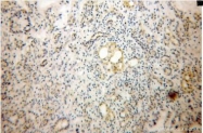 NB110-68135 - Dermatopontin