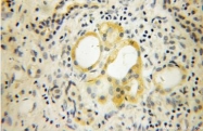 NB110-68135 - Dermatopontin
