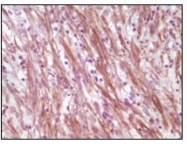 NB110-60508 - Desmin