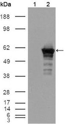 NB110-60508 - Desmin