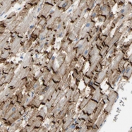 NBP1-85710 - Desmocollin-2