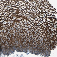 NBP1-85711 - Desmocollin-2