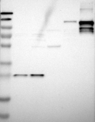 NBP1-85710 - Desmocollin-2