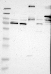 NBP1-85711 - Desmocollin-2