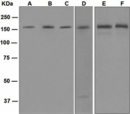 NBP1-95891 - Desmoglein-2