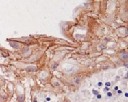 NB100-1643 - Desmoglein-3