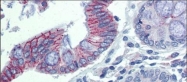 NBP1-59200 - Desmoglein-2