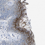 NBP1-88099 - Desmocollin-1