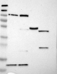 NBP1-88099 - Desmocollin-1