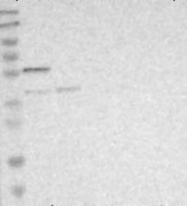 NBP1-87689 - DFNA5