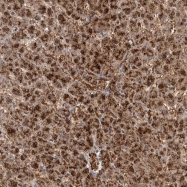 NBP1-87550 - Dishevelled-2 / DVL2