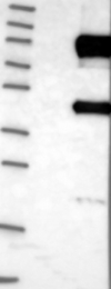 NBP1-87550 - Dishevelled-2 / DVL2