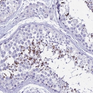 NBP1-91837 - DLX1