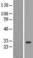 NBL1-09916 - Dlx1 Lysate