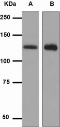 NBP1-95366 - DNMT3A