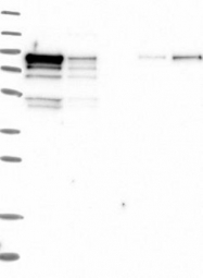 NBP1-85961 - DNMT3A
