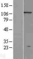 NBL1-09970 - Dnmt3a Lysate
