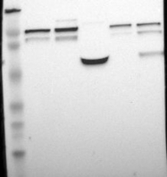 NBP1-85815 - DNMT3B