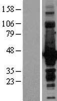 NBL1-09760 - Doublecortin Lysate