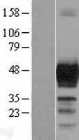 NBL1-09761 - Doublecortin Lysate