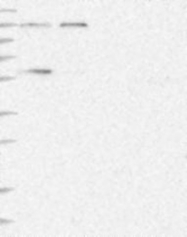 NBP1-87972 - DYNC1I1