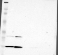 NBP1-84227 - DNAL4