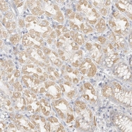 NBP1-82643 - DYRK1B