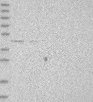 NBP1-85299 - Dysbindin
