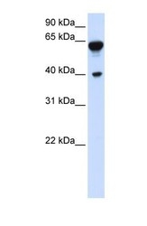 NBP1-56492 - DTNB