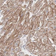 NBP1-89953 - Dystrophin / DMD