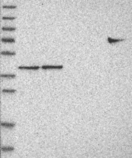 NBP1-89703 - ERAL1 / HERA