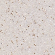 NBP1-90307 - UBE1 / UBA1