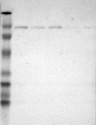 NBP1-90307 - UBE1 / UBA1