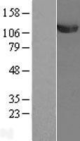 NBL1-17494 - E1 Ubiquitin Activating Enzyme Lysate