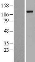 NBL1-17495 - E1 Ubiquitin Activating Enzyme Lysate