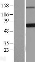 NBL1-10108 - EDC3 Lysate